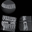 歯科用CT-撮影画像1